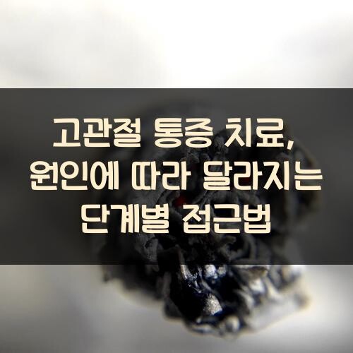 고관절 통증 치료, 원인에 따라 달라지는 단계별 접근법