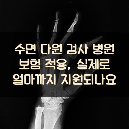 수면 다원 검사 병원 보험 적용, 실제로 얼마까지 지원되나요?